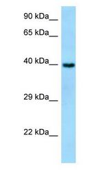 SYT7 / Synaptotagmin 7 Antibody - SYT7 antibody Western Blot of Fetal Liver.  This image was taken for the unconjugated form of this product. Other forms have not been tested.