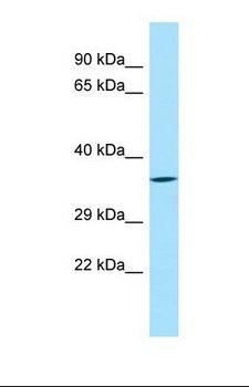 SYT8 Antibody - Western blot of Human MDA-MB-435S. SYT8 antibody dilution 1.0 ug/ml.  This image was taken for the unconjugated form of this product. Other forms have not been tested.