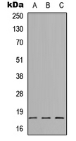 SYT8 Antibody - Western blot analysis of SYT8 expression in HEK293T (A); Raw264.7 (B); H9C2 (C) whole cell lysates.