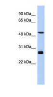 SYT9 / Synaptotagmin 9 Antibody - SYT9 antibody Western blot of Fetal Muscle lysate. This image was taken for the unconjugated form of this product. Other forms have not been tested.