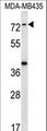 SYTL1 Antibody - SYTL1 Antibody western blot of MDA-MB435 cell line lysates (35 ug/lane). The SYTL1 antibody detected the SYTL1 protein (arrow).