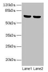 SYTL3 Antibody - Western blot All lanes: SYTL3 antibody at 5µg/ml Lane 1: A549 whole cell lysate Lane 2: THP-1 whole cell lysate Secondary Goat polyclonal to rabbit IgG at 1/10000 dilution Predicted band size: 69, 61 kDa Observed band size: 69 kDa