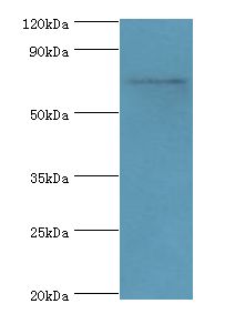 SYTL4 / Granuphilin Antibody - Western blot. All lanes: SYTL4 antibody at 3 ug/ml+A549 whole cell lysate. Secondary antibody: Goat polyclonal to rabbit at 1:10000 dilution. Predicted band size: 76 kDa. Observed band size: 76 kDa.