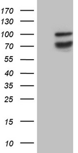 SYTL4 / Granuphilin Antibody - HEK293T cells were transfected with the pCMV6-ENTRY control. (Left lane) or pCMV6-ENTRY SYTL4. (Right lane) cDNA for 48 hrs and lysed
