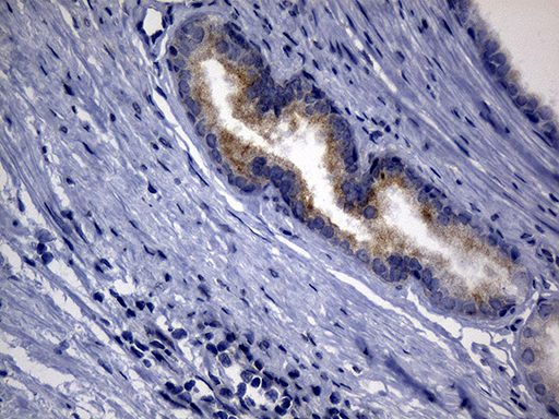 SYTL4 / Granuphilin Antibody - Immunohistochemical staining of paraffin-embedded Human prostate tissue within the normal limits using anti-SYTL4 mouse monoclonal antibody. (Heat-induced epitope retrieval by 1mM EDTA in 10mM Tris buffer. (pH8.5) at 120°C for 3 min. (1:500)