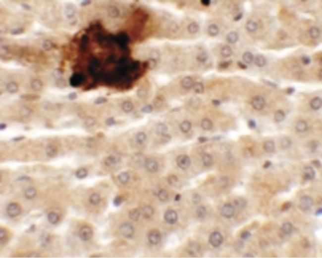 SYTL5 Antibody - Immunohistochemistry of SYTL2 in rat liver tissue with SYTL2 antibody at 5 ug/ml.