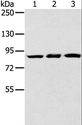 SYTL5 Antibody - Western blot analysis of Human bladder carcinoma tissue, mouse liver and human fetal liver tissue, using SYTL5 Polyclonal Antibody at dilution of 1:400.