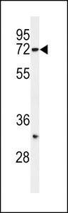 SYVN1 / HRD1 Antibody - Western blot of HRD1 Antibody in SK-BR-3 cell line lysates (35 ug/lane). HRD1 (arrow) was detected using the purified antibody.