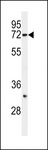 SYVN1 / HRD1 Antibody - Western blot of HRD1 Antibody in SK-BR-3 cell line lysates (35 ug/lane). HRD1 (arrow) was detected using the purified antibody.