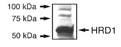 SYVN1 / HRD1 Antibody - Detection of HRD1 in an endogenous 293T cell lysate.