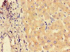 SYVN1 / HRD1 Antibody - Immunohistochemistry of paraffin-embedded human liver tissue using SYVN1 Antibody at dilution of 1:100