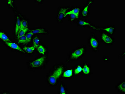 SYVN1 / HRD1 Antibody - Immunofluorescent analysis of Hela cells using SYVN1 Antibody at dilution of 1:100 and Alexa Fluor 488-congugated AffiniPure Goat Anti-Rabbit IgG(H+L)
