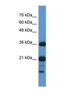 SZRD1 / C1orf144 Antibody - C1orf144 antibody Western blot of HepG2 Cell lysate. Antibody concentration 1 ug/ml. This image was taken for the unconjugated form of this product. Other forms have not been tested.
