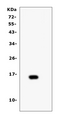 T Cell Receptor Alpha Constant Antibody - Western blot analysis of TCR alpha using anti-TCR alpha antibody. Electrophoresis was performed on a 5-20% SDS-PAGE gel at 70V (Stacking gel) / 90V (Resolving gel) for 2-3 hours. Lane 1: recombinant human TCR alpha protein 1ng. After Electrophoresis, proteins were transferred to a Nitrocellulose membrane at 150mA for 50-90 minutes. Blocked the membrane with 5% Non-fat Milk/ TBS for 1.5 hour at RT. The membrane was incubated with rabbit anti-TCR alpha antigen affinity purified polyclonal antibody at 0.5 µg/mL overnight at 4°C, then washed with TBS-0.1% Tween 3 times with 5 minutes each and probed with a goat anti-rabbit IgG-HRP secondary antibody at a dilution of 1:10000 for 1.5 hour at RT. The signal is developed using an Enhanced Chemiluminescent detection (ECL) kit with Tanon 5200 system. A specific band was detected for TCR alpha at approximately 16KD. The expected band size for TCR alpha is at 16KD.