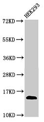 T-cell receptor beta-chain V region, clone WBDM28A Antibody - Positive Western Blot detected in HEK293 whole cell lysate. All lanes: TCRB antibody at 3 µg/ml Secondary Goat polyclonal to rabbit IgG at 1/50000 dilution. Predicted band size: 15 KDa. Observed band size: 15 KDa