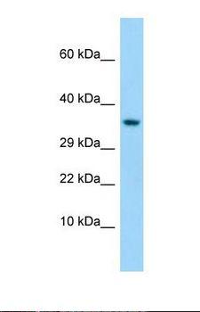 T1R1 / TAS1R1 Antibody - Western blot of Human HepG2. TAS1R1 antibody dilution 1.0 ug/ml.  This image was taken for the unconjugated form of this product. Other forms have not been tested.