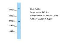T1R1 / TAS1R1 Antibody -  This image was taken for the unconjugated form of this product. Other forms have not been tested.