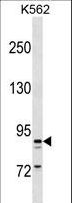 T1R3 / TAS1R3 Antibody - TAS1R3 Antibody western blot of K562 cell line lysates (35 ug/lane). The TAS1R3 antibody detected the TAS1R3 protein (arrow).
