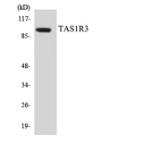 T1R3 / TAS1R3 Antibody - Western blot analysis of the lysates from HeLa cells using TAS1R3 antibody.