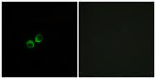 T1R3 / TAS1R3 Antibody - Immunofluorescence analysis of MCF7 cells, using TAS1R3 Antibody. The picture on the right is blocked with the synthesized peptide.