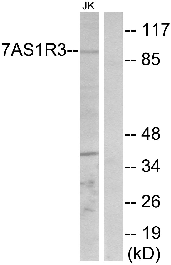 T1R3 / TAS1R3 Antibody - Western blot analysis of lysates from Jurkat cells, using TAS1R3 Antibody. The lane on the right is blocked with the synthesized peptide.