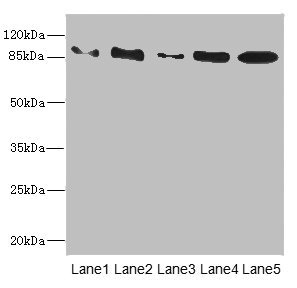 T1R3 / TAS1R3 Antibody - Western blot All Lanes: TAS1R3antibody at 1.48ug/ml Lane 1: K562 whole cell lysate Lane 2: HL60 whole cell lysate Lane 3: Jurkat whole cell lysate Lane 4: Hela whole cell lysate Lane 5: HepG-2 whole cell lysate Secondary Goat polyclonal to rabbit IgG at 1/10000 dilution Predicted band size: 93 kDa Observed band size: 93 kDa