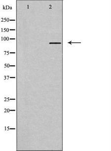 T1R3 / TAS1R3 Antibody - Western blot analysis of extracts of Jurkat cells using TAS1R3 antibody. The lane on the left is treated with the antigen-specific peptide.