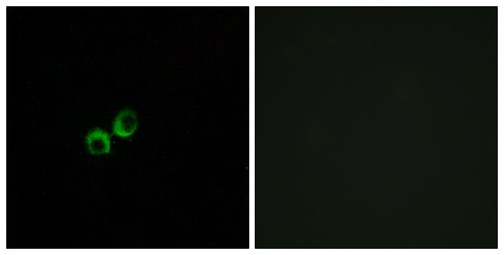 T1R3 / TAS1R3 Antibody - Peptide - + Immunofluorescence analysis of MCF-7 cells, using TAS1R3 antibody.