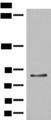 T1R3 / TAS1R3 Antibody - Western blot analysis of LO2 cell lysate  using TAS1R3 Polyclonal Antibody at dilution of 1:400