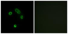 T2R13 / TAS2R13 Antibody - Immunofluorescence analysis of MCF7 cells, using TAS2R13 Antibody. The picture on the right is blocked with the synthesized peptide.