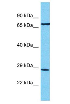 T2R13 / TAS2R13 Antibody - T2R13 / TAS2R13 antibody Western Blot of HCT15. Antibody dilution: 1 ug/ml.  This image was taken for the unconjugated form of this product. Other forms have not been tested.