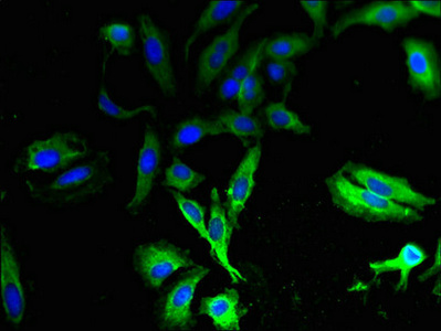 T2R13 / TAS2R13 Antibody - Immunofluorescent analysis of Hela cells using TAS2R13 Antibody at dilution of 1:100 and Alexa Fluor 488-congugated AffiniPure Goat Anti-Rabbit IgG(H+L)