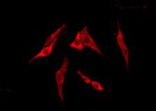 T2R13 / TAS2R13 Antibody - Staining HeLa cells by IF/ICC. The samples were fixed with PFA and permeabilized in 0.1% Triton X-100, then blocked in 10% serum for 45 min at 25°C. The primary antibody was diluted at 1:200 and incubated with the sample for 1 hour at 37°C. An Alexa Fluor 594 conjugated goat anti-rabbit IgG (H+L) Ab, diluted at 1/600, was used as the secondary antibody.