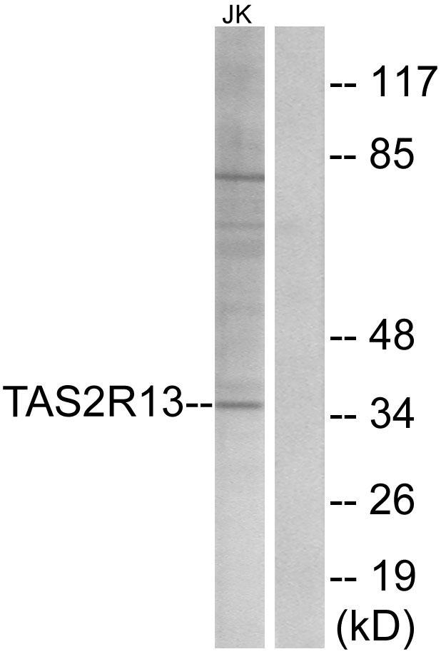 T2R13 / TAS2R13 Antibody - Western blot analysis of extracts from Jurkat cells, using TAS2R13 antibody.