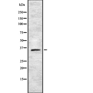 T2R42 / TAS2R42 Antibody - Western blot analysis of TAS2R42 using 293 whole cells lysates