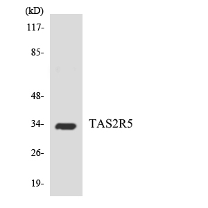 T2R5 / TAS2R5 Antibody - Western blot analysis of the lysates from HepG2 cells using TAS2R5 antibody.