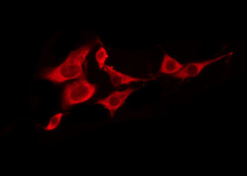 T2R5 / TAS2R5 Antibody - Staining LOVO cells by IF/ICC. The samples were fixed with PFA and permeabilized in 0.1% Triton X-100, then blocked in 10% serum for 45 min at 25°C. The primary antibody was diluted at 1:200 and incubated with the sample for 1 hour at 37°C. An Alexa Fluor 594 conjugated goat anti-rabbit IgG (H+L) Ab, diluted at 1/600, was used as the secondary antibody.