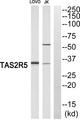 T2R5 / TAS2R5 Antibody - Western blot analysis of extracts from LOVO cells and Jurkat cells, using TAS2R5 antibody.
