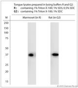T2R5 / TAS2R5 Antibody - WB on tongue lysates. Blocking: 1% LFDM for 30 min at RT; primary antibody: dilution 1:4000 incubated overnight at 4°C.