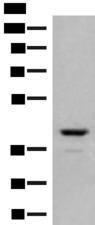 TAAR2 / GPR58 Antibody - Western blot analysis of Human fetal brain tissue lysate  using TAAR2 Polyclonal Antibody at dilution of 1:350