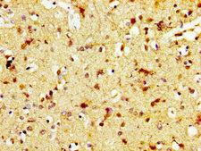 TAAR5 Antibody - Immunohistochemistry image at a dilution of 1:600 and staining in paraffin-embedded human brain tissue performed on a Leica BondTM system. After dewaxing and hydration, antigen retrieval was mediated by high pressure in a citrate buffer (pH 6.0) . Section was blocked with 10% normal goat serum 30min at RT. Then primary antibody (1% BSA) was incubated at 4 °C overnight. The primary is detected by a biotinylated secondary antibody and visualized using an HRP conjugated SP system.