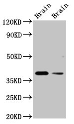 TAAR5 Antibody - Positive Western Blot detected in Rat brain tissue, Mouse brain tissue. All lanes: TAAR5 antibody at 3 µg/ml Secondary Goat polyclonal to rabbit IgG at 1/50000 dilution. Predicted band size: 39 KDa. Observed band size: 39 KDa