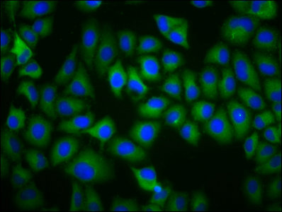 TAAR5 Antibody - Immunofluorescence staining of Hela cells with TAAR5 Antibody at 1:200, counter-stained with DAPI. The cells were fixed in 4% formaldehyde, permeabilized using 0.2% Triton X-100 and blocked in 10% normal Goat Serum. The cells were then incubated with the antibody overnight at 4°C. The secondary antibody was Alexa Fluor 488-congugated AffiniPure Goat Anti-Rabbit IgG(H+L).