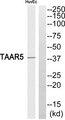 TAAR5 Antibody - Western blot analysis of extracts from HuvEc cells, using TAAR5 antibody.