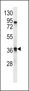 TAAR9 Antibody - TAAR9 Antibody western blot of mouse stomach tissue lysates (35 ug/lane). The TAAR9 antibody detected the TAAR9 protein (arrow).