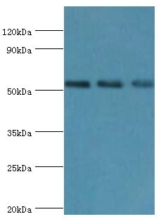TAB1 Antibody - Western blot. All lanes: TGF-beta-activated kinase 1 and MAP3K7-binding protein 1 antibody at 7 ug/ml. Lane 1: K562 whole cell lysate. Lane 2: HeLa whole cell lysate. Lane 3: mouse heart tissue. Secondary antibody: Goat polyclonal to rabbit at 1:10000 dilution. Predicted band size: 55 kDa. Observed band size: 55 kDa.