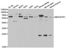 TAB1 Antibody - Western blot analysis of extracts of various cells.