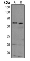 TAB1 Antibody - Western blot analysis of TAB1 expression in Hela (A), HEK293T (B) whole cell lysates.