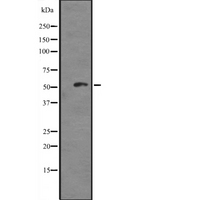 TAB1 Antibody - Western blot analysis of TAB1 expression in MCF-7 cells lysate. The lane on the left is treated with the antigen-specific peptide.