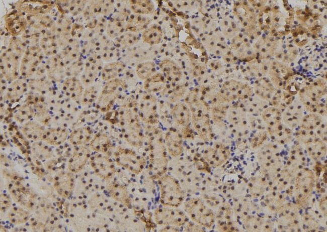 TAB1 Antibody - 1:100 staining mouse kidney tissue by IHC-P. The sample was formaldehyde fixed and a heat mediated antigen retrieval step in citrate buffer was performed. The sample was then blocked and incubated with the antibody for 1.5 hours at 22°C. An HRP conjugated goat anti-rabbit antibody was used as the secondary.